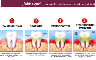 Encías inflamadas