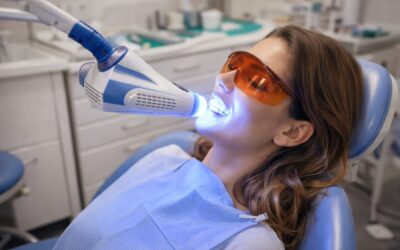 Blanqueamiento dental: todo lo que debes saber antes de empezar