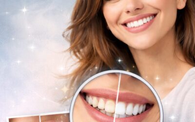 Diseño de sonrisa: transforma tu sonrisa de forma natural